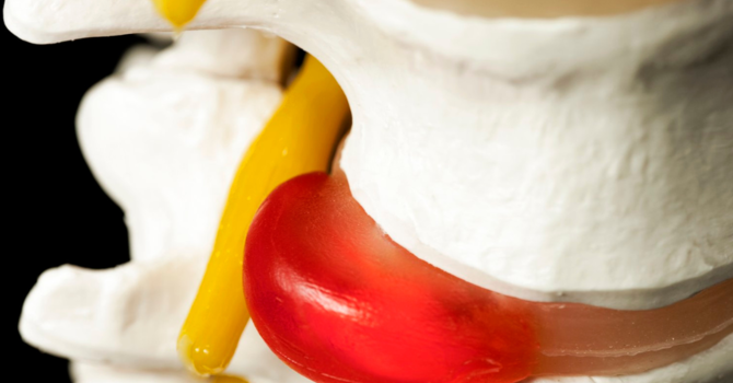 The All-Natural Solution to Foot Pain: Why Athletes Go to The Chiropractor First