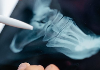 On-Site Digital X-Ray