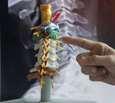anatomy of upper cervical injury assessment 